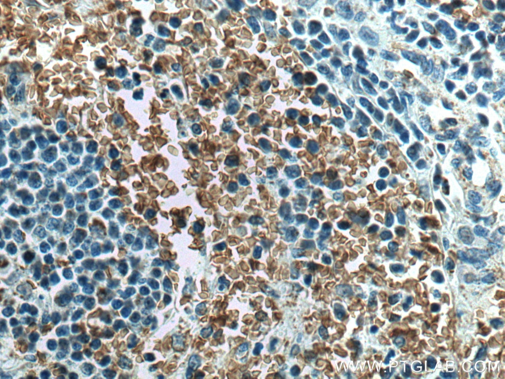 Immunohistochemistry (IHC) staining of human spleen tissue using GYPC Polyclonal antibody (18147-1-AP)