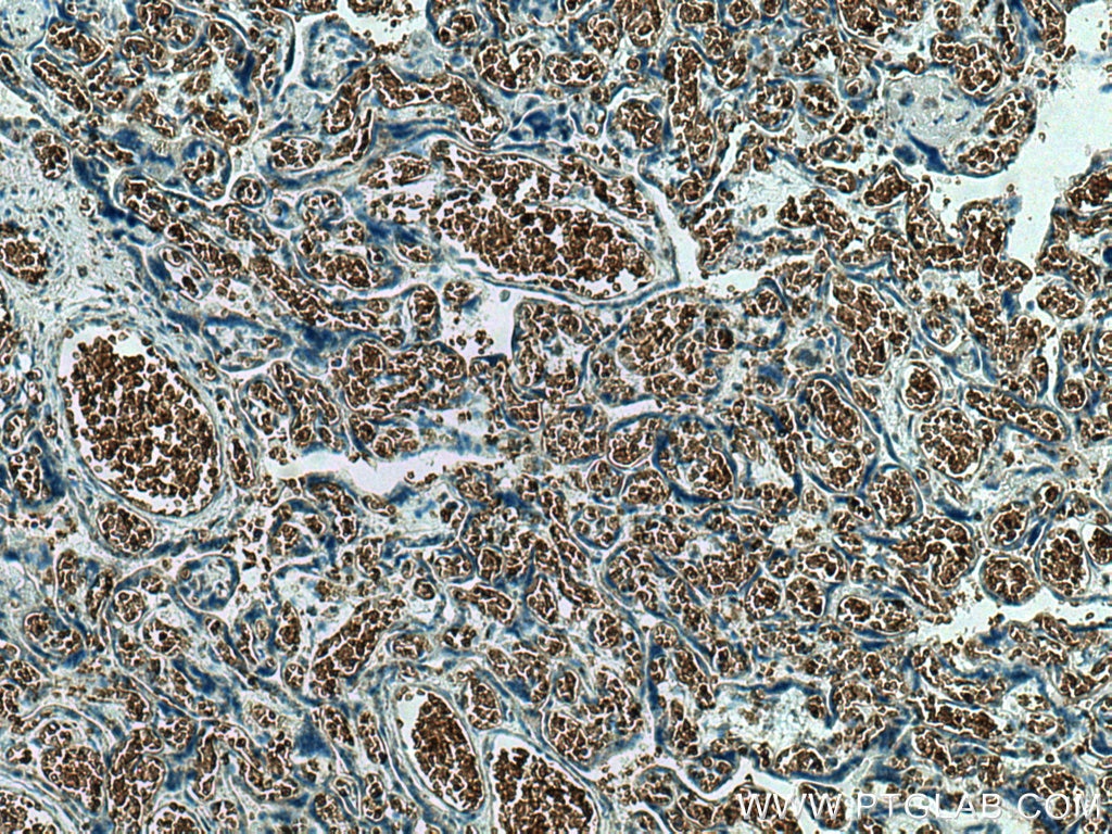 Immunohistochemistry (IHC) staining of human placenta tissue using GYPC Polyclonal antibody (18147-1-AP)