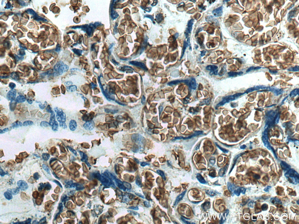 Immunohistochemistry (IHC) staining of human placenta tissue using GYPC Polyclonal antibody (18147-1-AP)