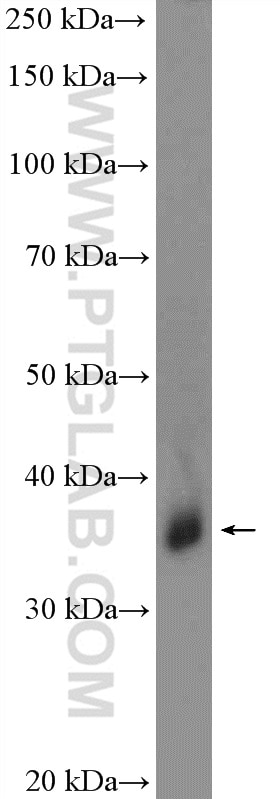 Western Blot (WB) analysis of human blood using GYPC Polyclonal antibody (18147-1-AP)