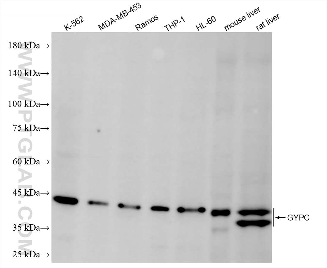 Western Blot (WB) analysis of various lysates using GYPC Recombinant antibody (86574-1-RR)
