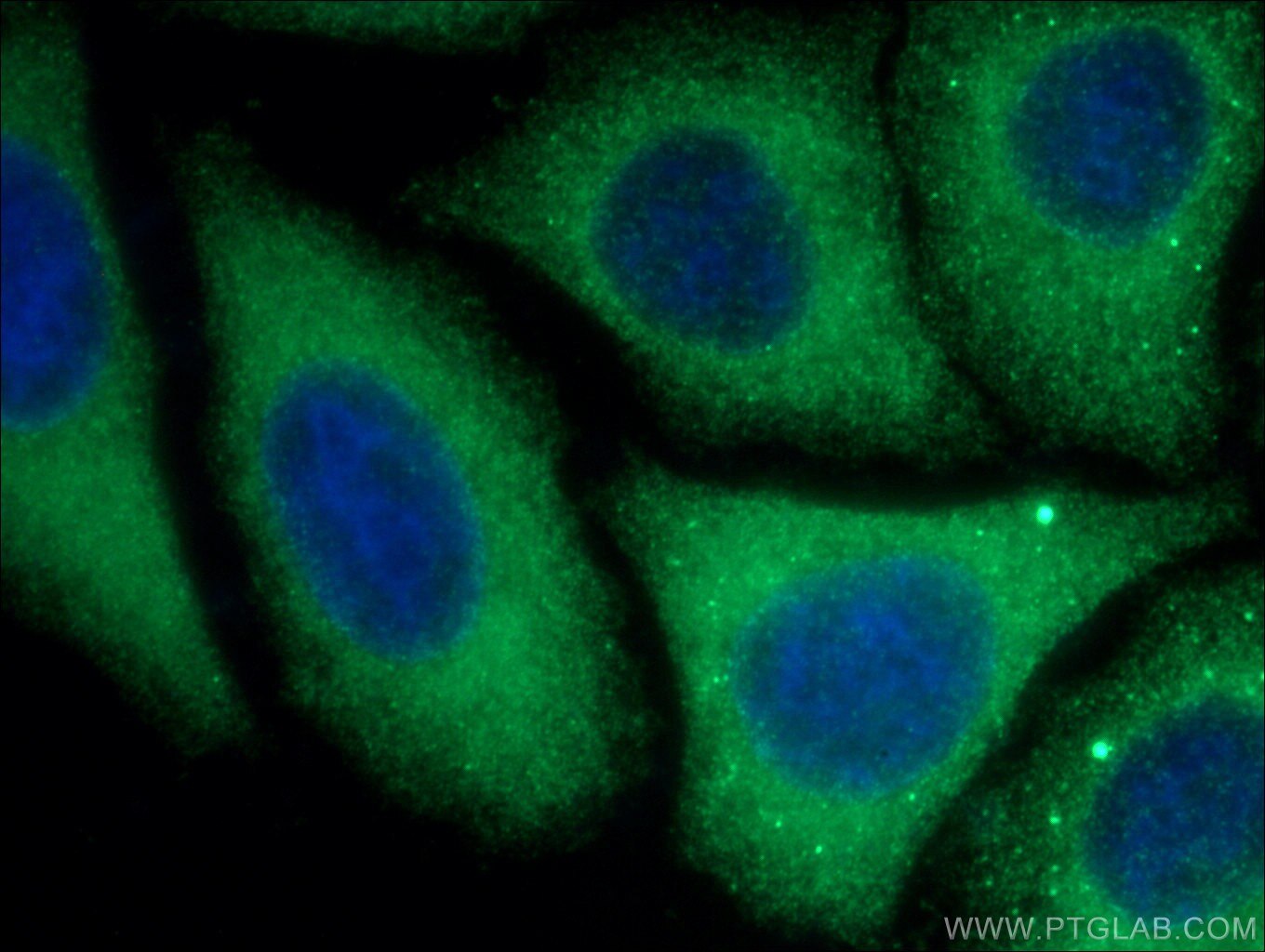 Immunofluorescence (IF) / fluorescent staining of HepG2 cells using GYS1 Polyclonal antibody (10566-1-AP)