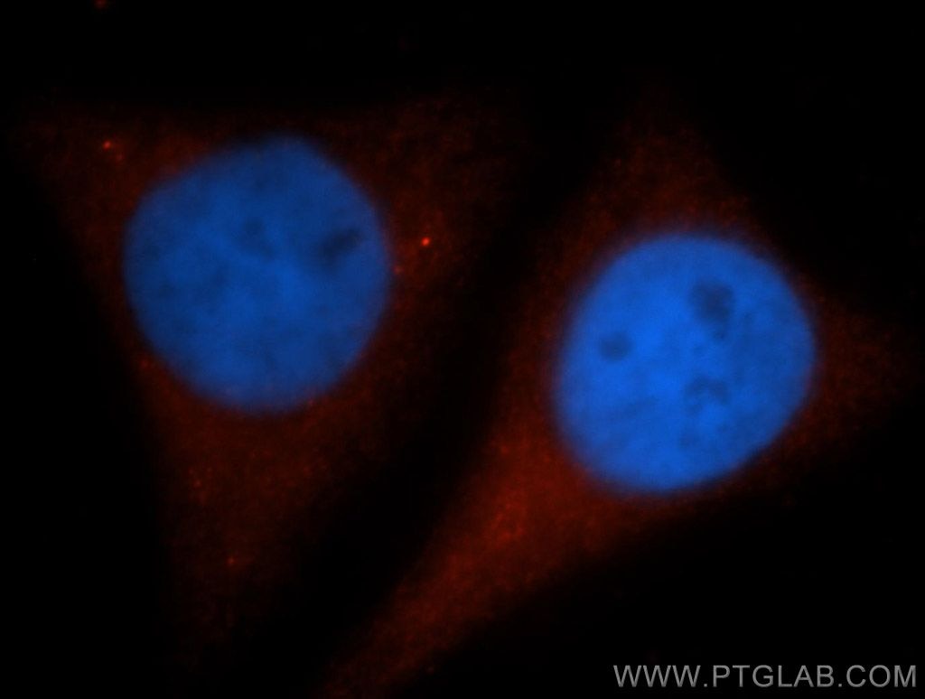 Immunofluorescence (IF) / fluorescent staining of HepG2 cells using GYS1 Polyclonal antibody (10566-1-AP)