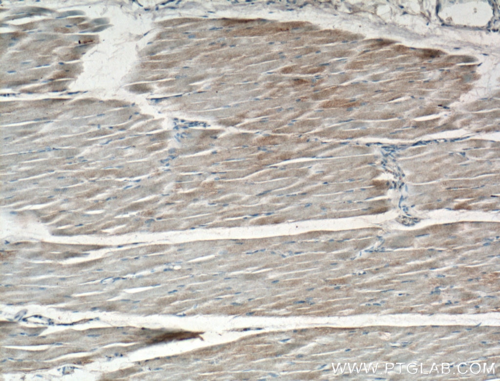 Immunohistochemistry (IHC) staining of human skeletal muscle tissue using GYS1 Polyclonal antibody (10566-1-AP)