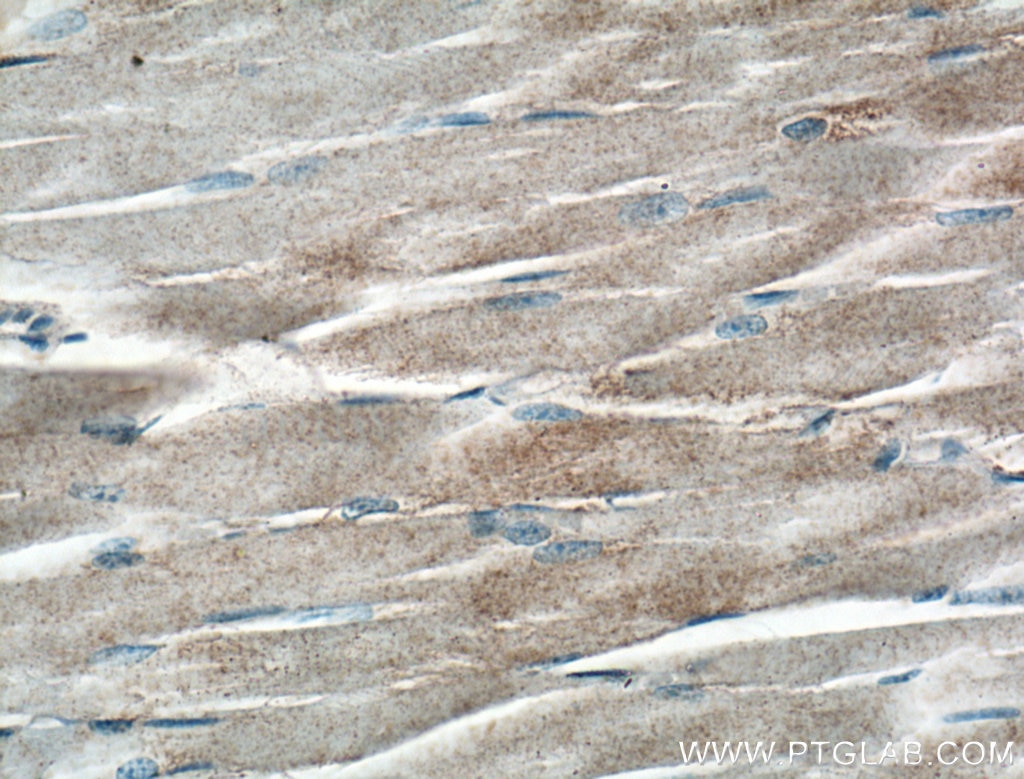 Immunohistochemistry (IHC) staining of human skeletal muscle tissue using GYS1 Polyclonal antibody (10566-1-AP)