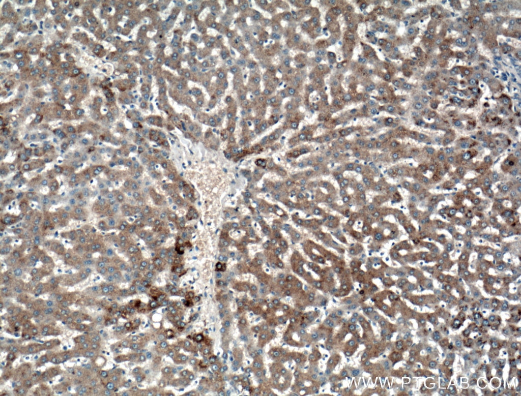 Immunohistochemistry (IHC) staining of human liver tissue using GYS1 Polyclonal antibody (10566-1-AP)