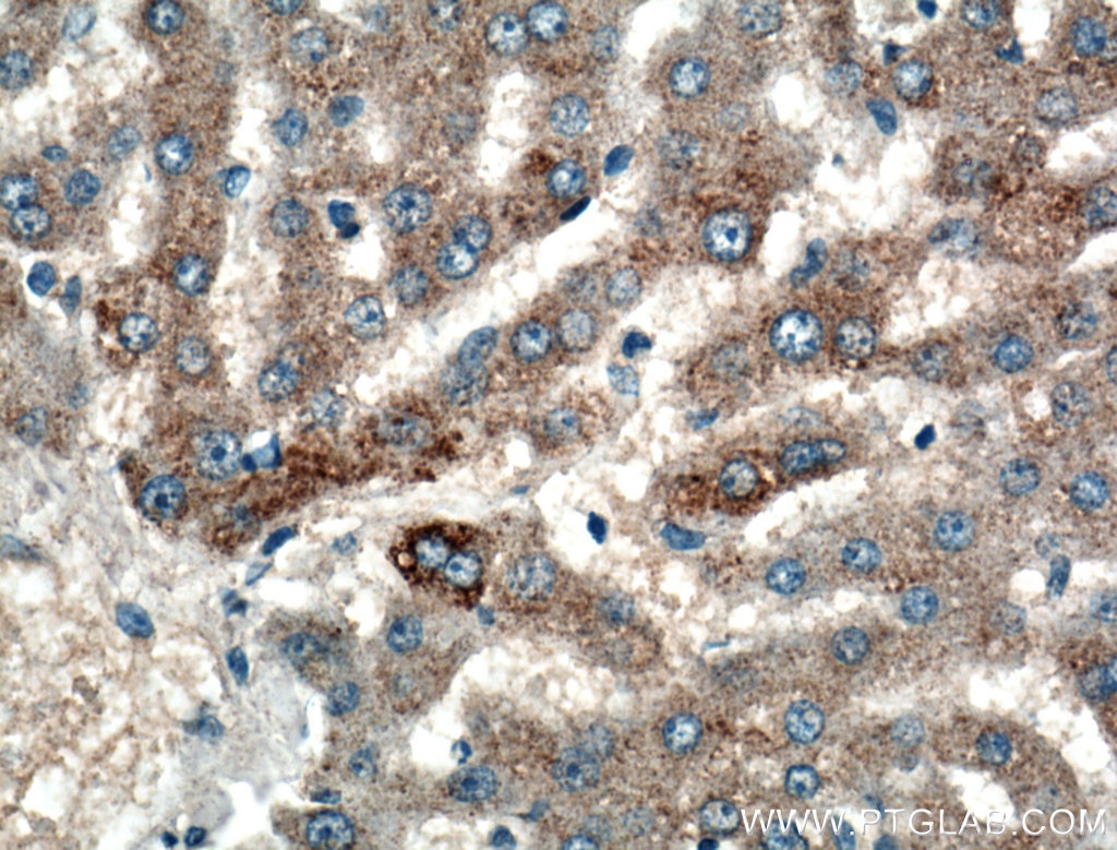 Immunohistochemistry (IHC) staining of human liver tissue using GYS1 Polyclonal antibody (10566-1-AP)
