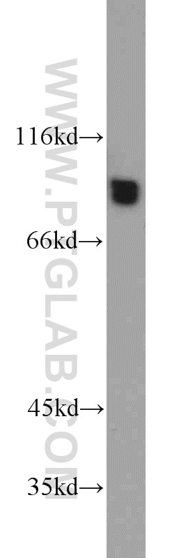 Western Blot (WB) analysis of K-562 cells using GYS1 Polyclonal antibody (10566-1-AP)