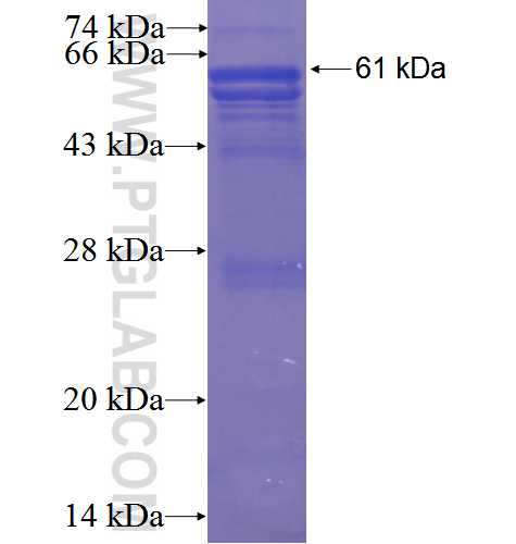 GYS1 fusion protein Ag0857 SDS-PAGE