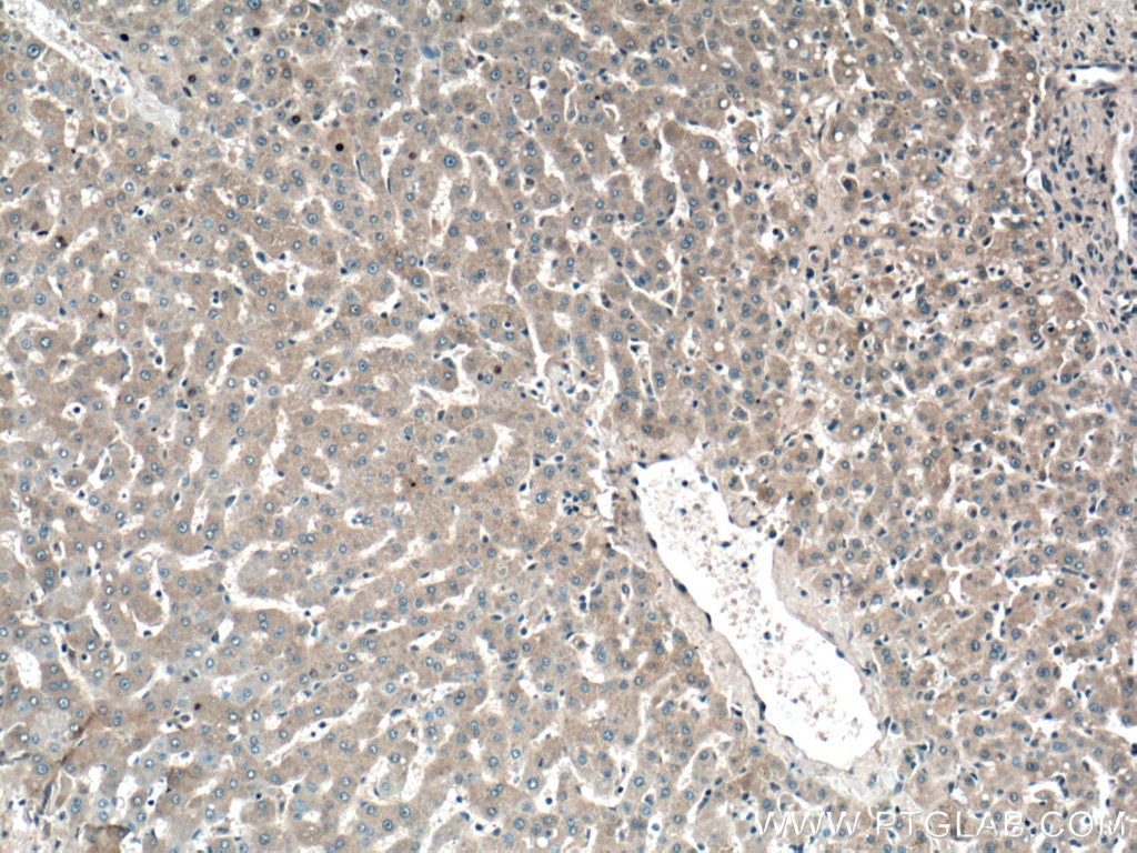 Immunohistochemistry (IHC) staining of human liver tissue using GYS2 Polyclonal antibody (22371-1-AP)