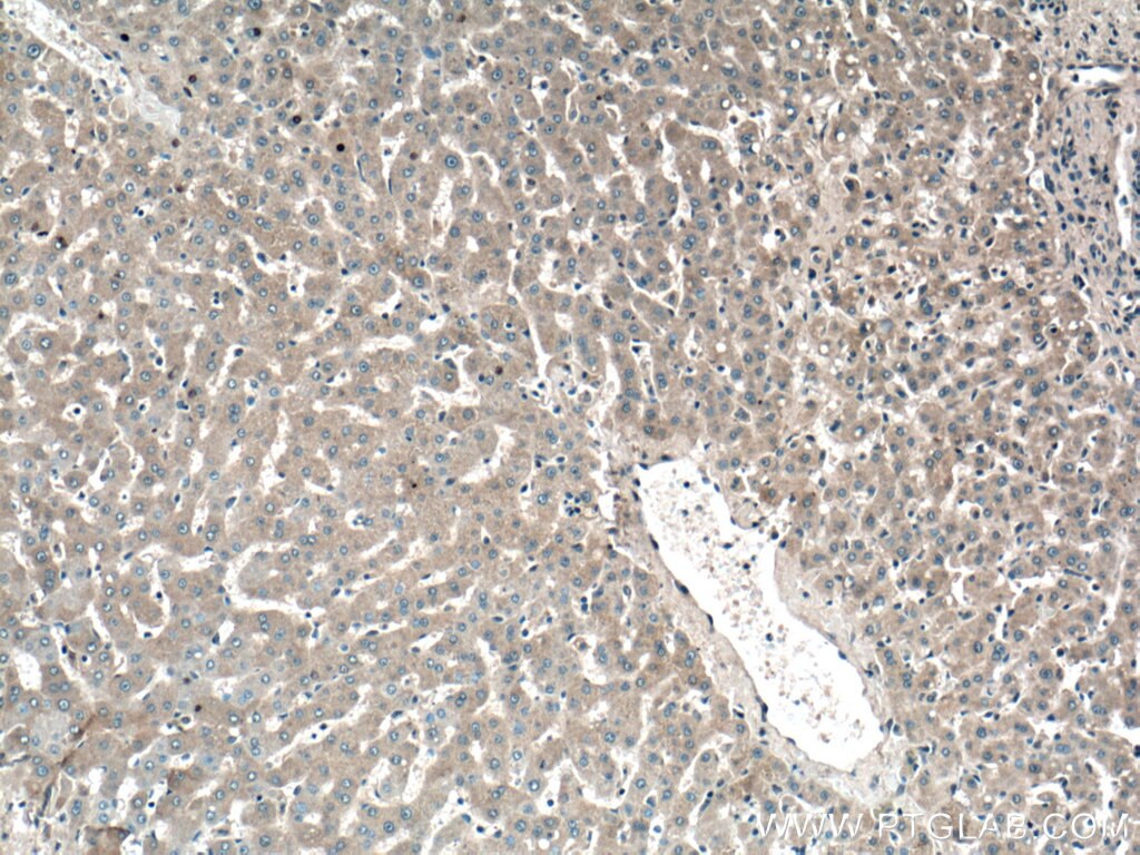 Immunohistochemistry (IHC) staining of human liver tissue using GYS2 Polyclonal antibody (22371-1-AP)