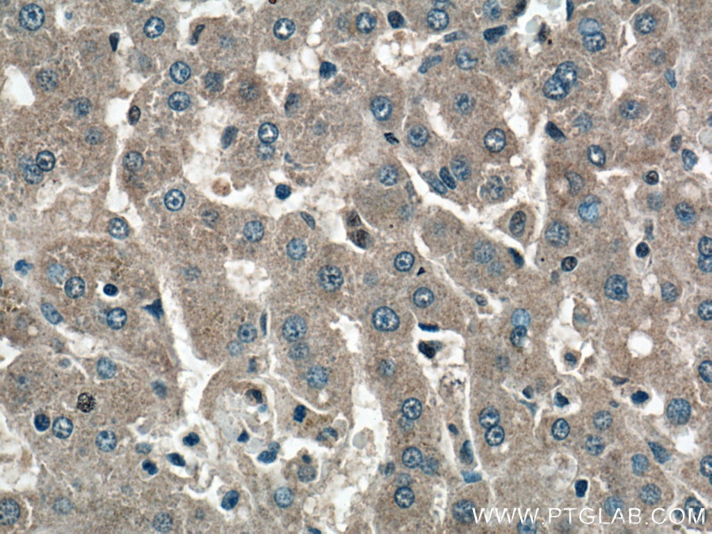 Immunohistochemistry (IHC) staining of human liver tissue using GYS2 Polyclonal antibody (22371-1-AP)