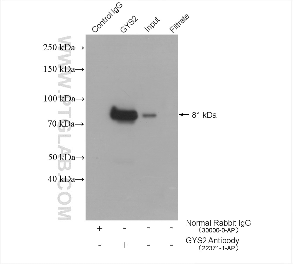 Immunoprecipitation (IP) experiment of rat liver tissue using GYS2 Polyclonal antibody (22371-1-AP)