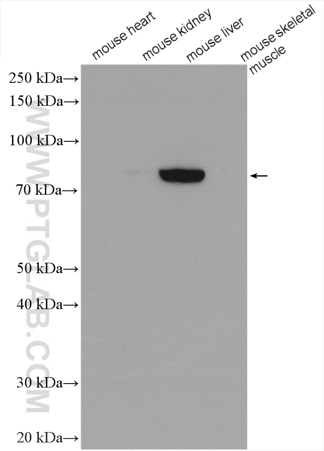 Western Blot (WB) analysis of various lysates using GYS2 Polyclonal antibody (22371-1-AP)