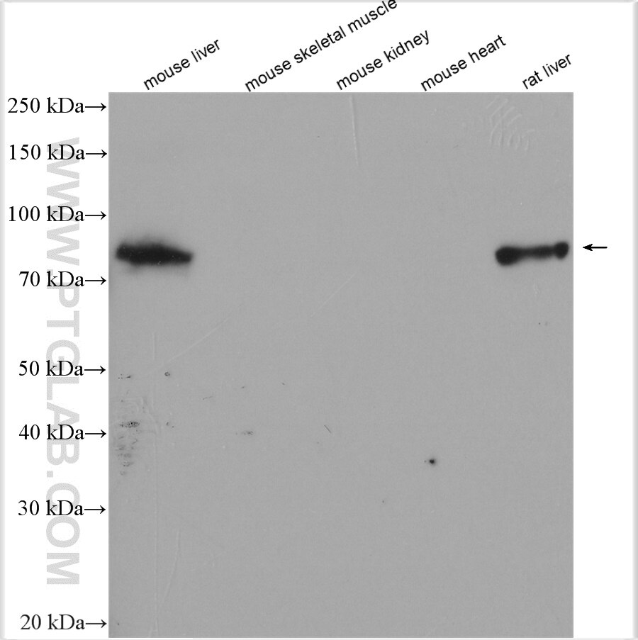 Western Blot (WB) analysis of various lysates using GYS2 Polyclonal antibody (22371-1-AP)