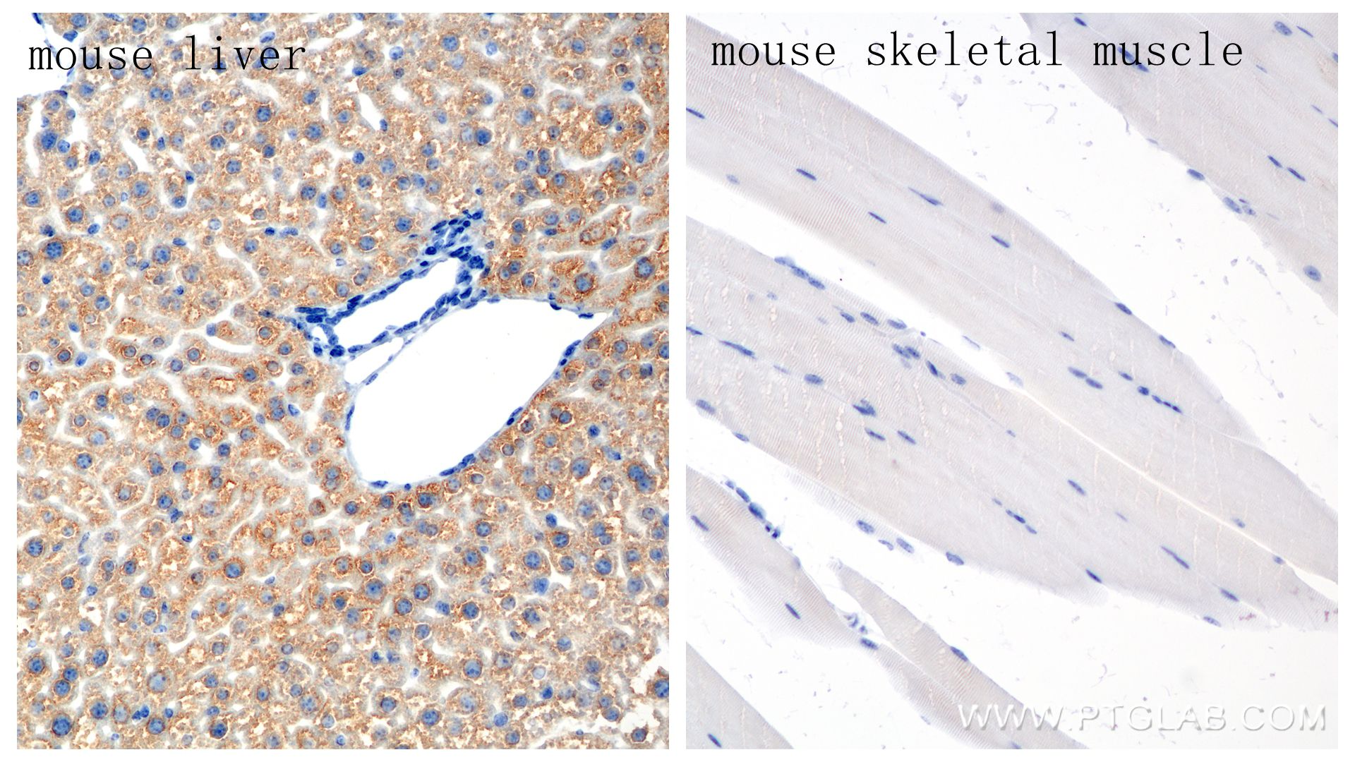 Immunohistochemistry (IHC) staining of mouse liver tissue using GYS2 Recombinant antibody (85122-4-RR)