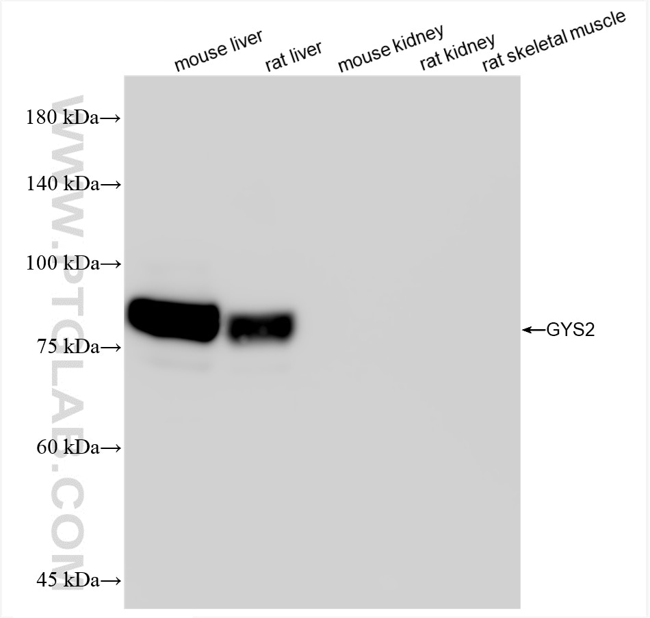 Western Blot (WB) analysis of various lysates using GYS2 Recombinant antibody (85122-4-RR)