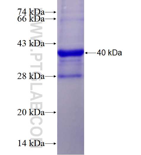 GYS2 fusion protein Ag18012 SDS-PAGE