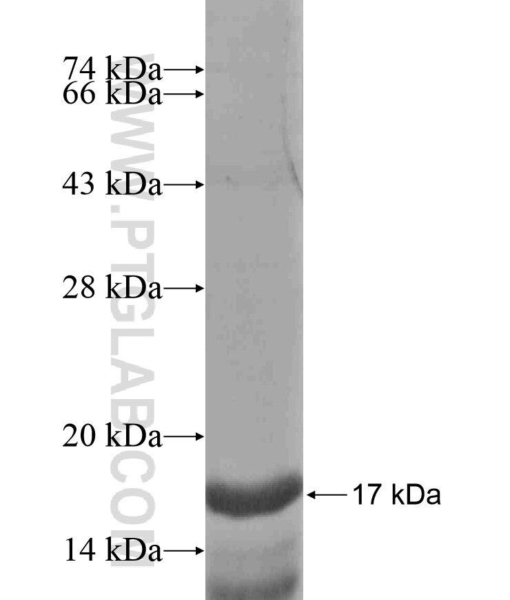 GYS2 fusion protein Ag18262 SDS-PAGE