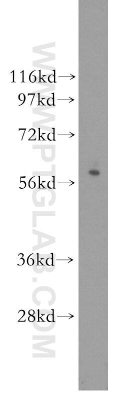 Granzyme A