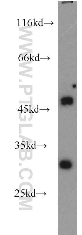 Western Blot (WB) analysis of mouse kidney tissue using Granzyme A Polyclonal antibody (11288-1-AP)