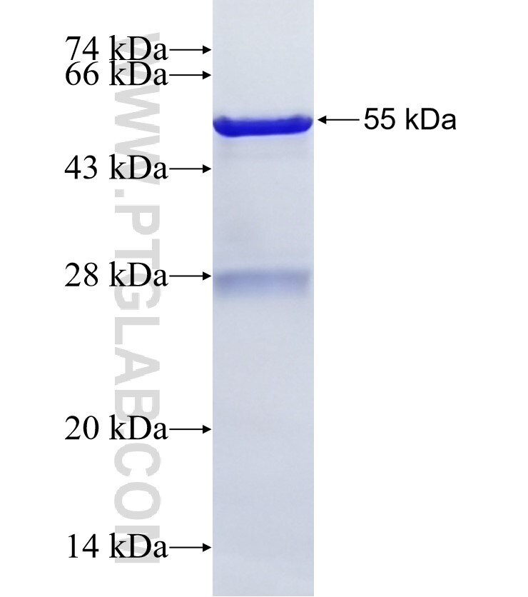 GZMA fusion protein Ag1818 SDS-PAGE