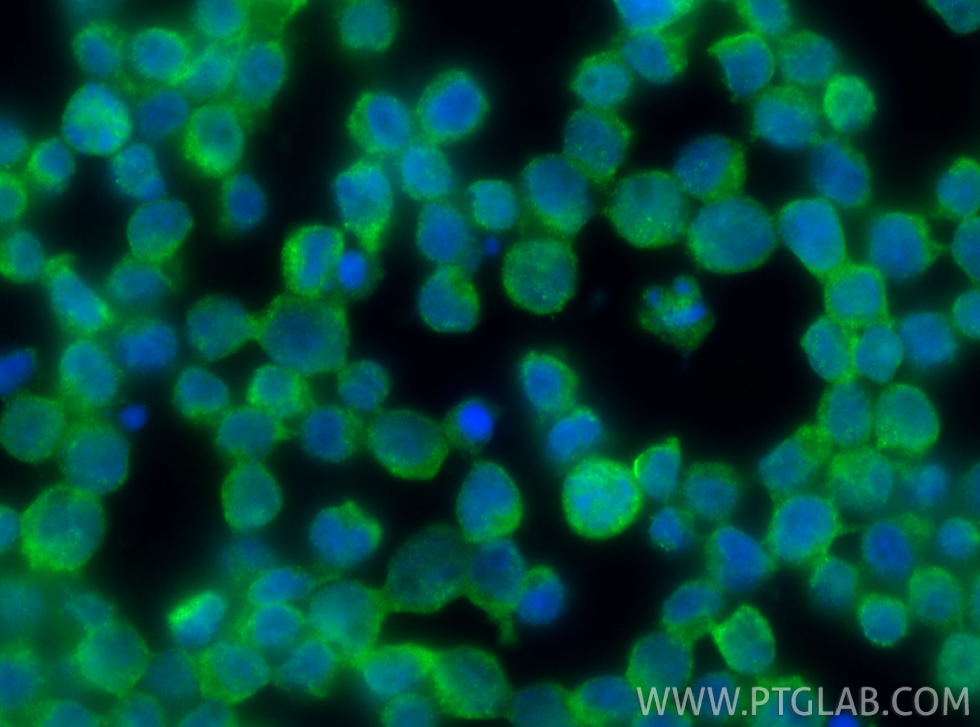 Immunofluorescence (IF) / fluorescent staining of Jurkat cells using Granzyme B Polyclonal antibody (13588-1-AP)