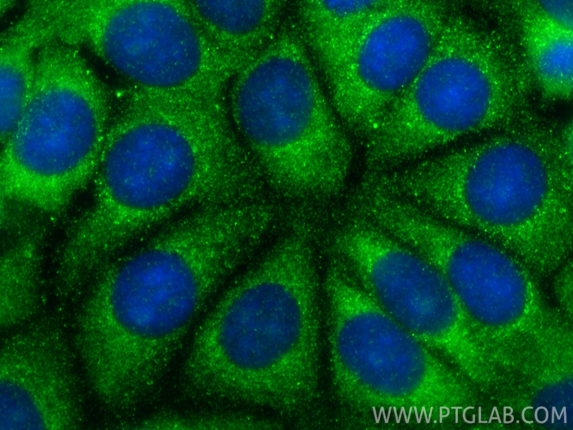 Immunofluorescence (IF) / fluorescent staining of MCF-7 cells using Granzyme B Polyclonal antibody (13588-1-AP)
