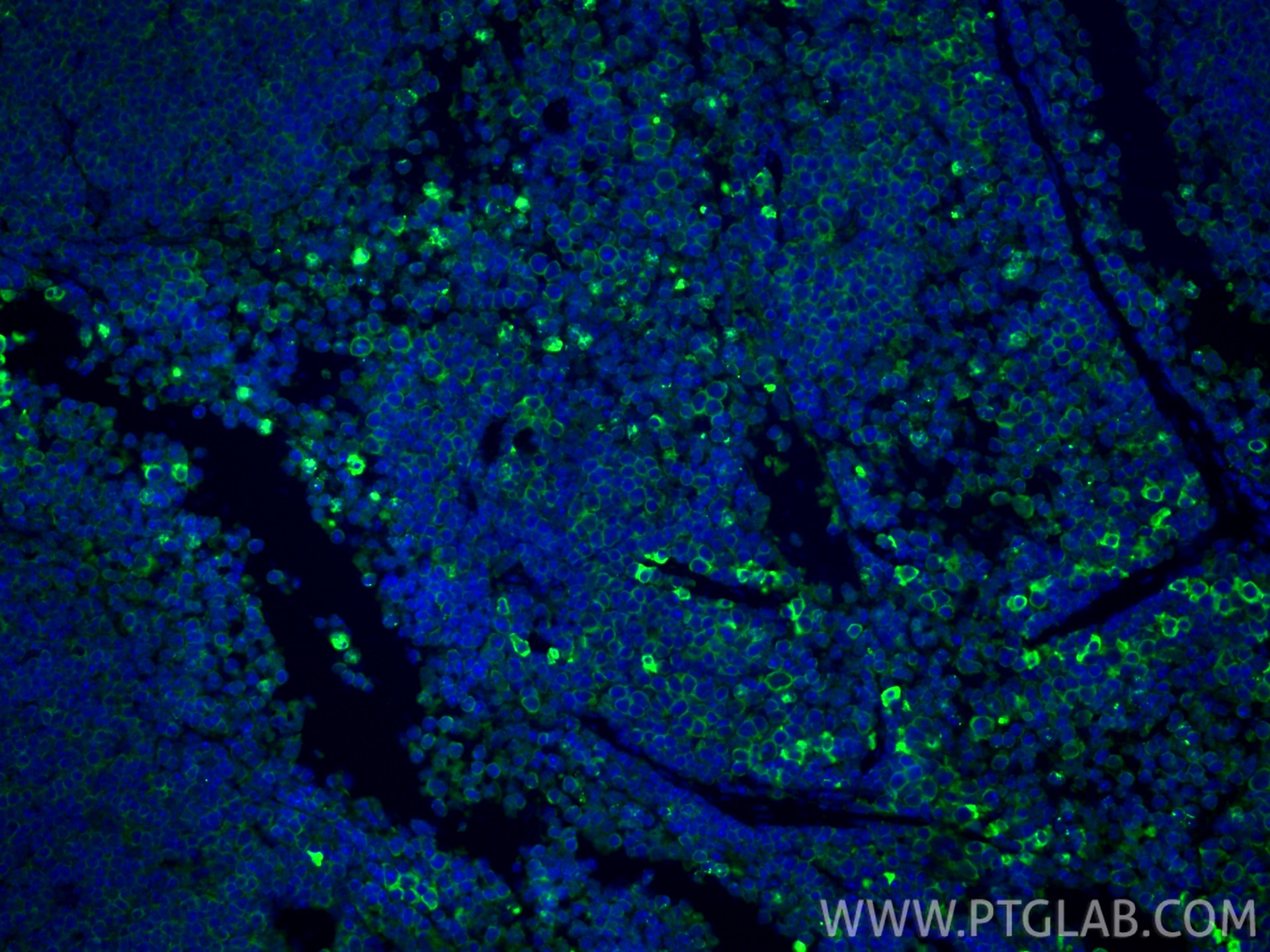 Immunofluorescent analysis of (4% PFA) fixed paraffin-embedded mouse spleen tissue using Granzyme B antibody (13588-1-AP) at dilution of 1:200 and CoraLite®488-Conjugated Goat Anti-Rabbit IgG(H+L) (SA00013-2). Heat mediated antigen retrieval with Tris-EDTA buffer (pH 9.0). Immunofluorescence (IF) / fluorescent staining of mouse spleen tissue using Granzyme B Polyclonal antibody (13588-1-AP)