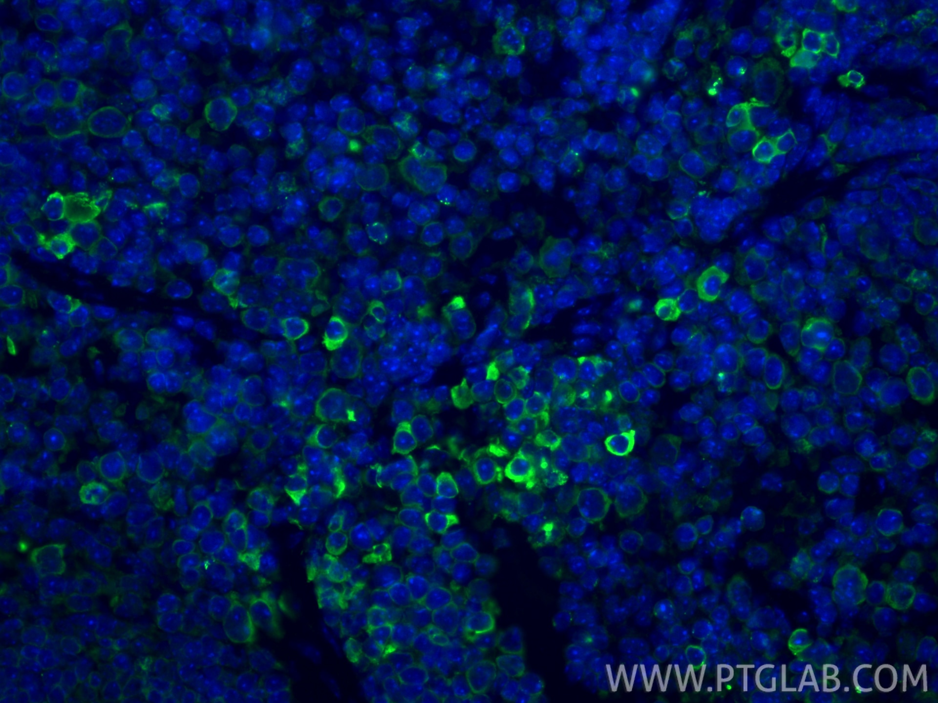 Immunofluorescent analysis of (4% PFA) fixed paraffin-embedded mouse spleen tissue using Granzyme B antibody (13588-1-AP) at dilution of 1:200 and CoraLite®488-Conjugated Goat Anti-Rabbit IgG(H+L) (SA00013-2). Heat mediated antigen retrieval with Tris-EDTA buffer (pH 9.0). Immunofluorescence (IF) / fluorescent staining of mouse spleen tissue using Granzyme B Polyclonal antibody (13588-1-AP)