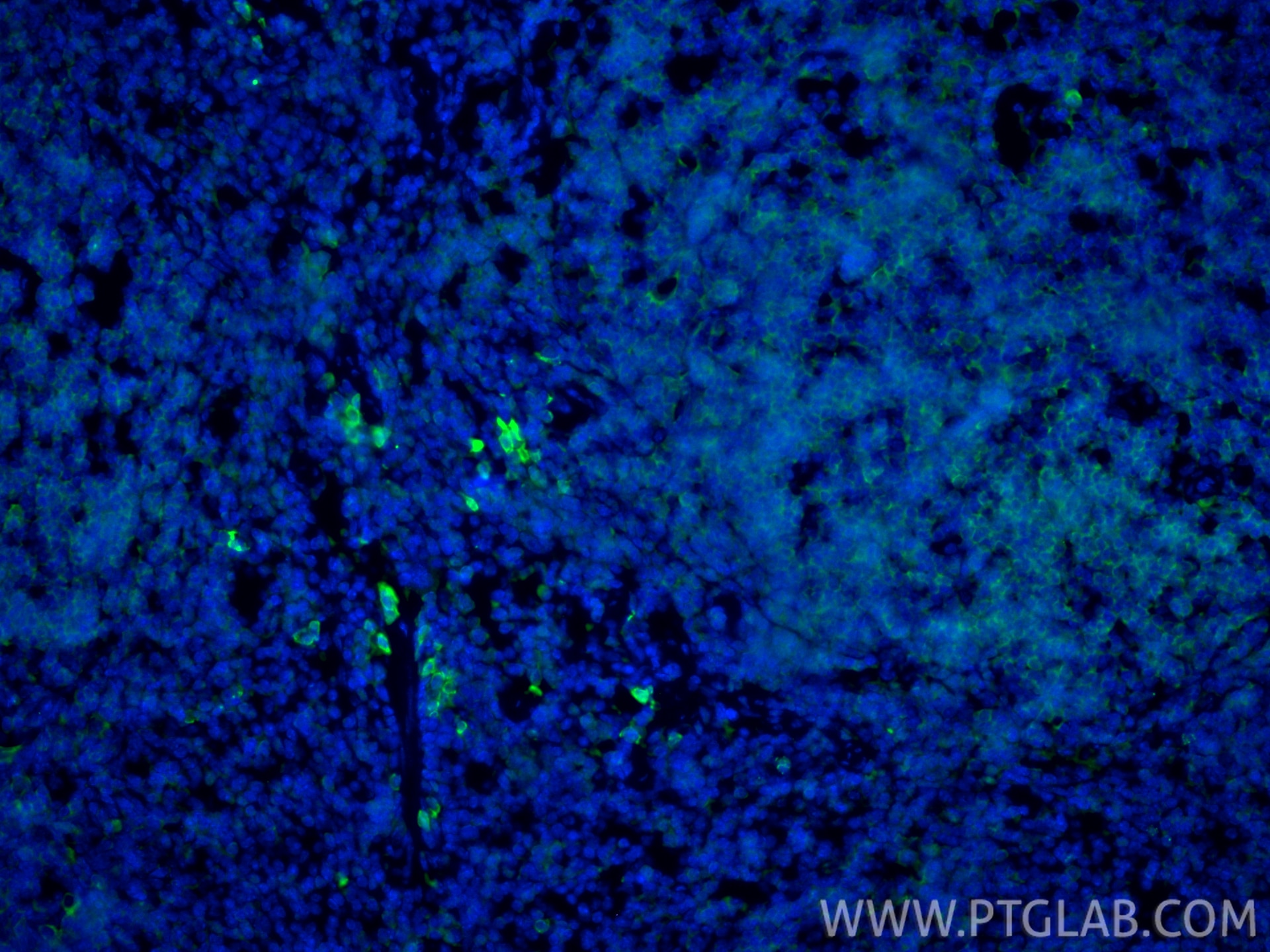 IF Staining of mouse spleen using 13588-1-AP Immunofluorescence (IF) / fluorescent staining of mouse spleen tissue using Granzyme B Polyclonal antibody (13588-1-AP)
