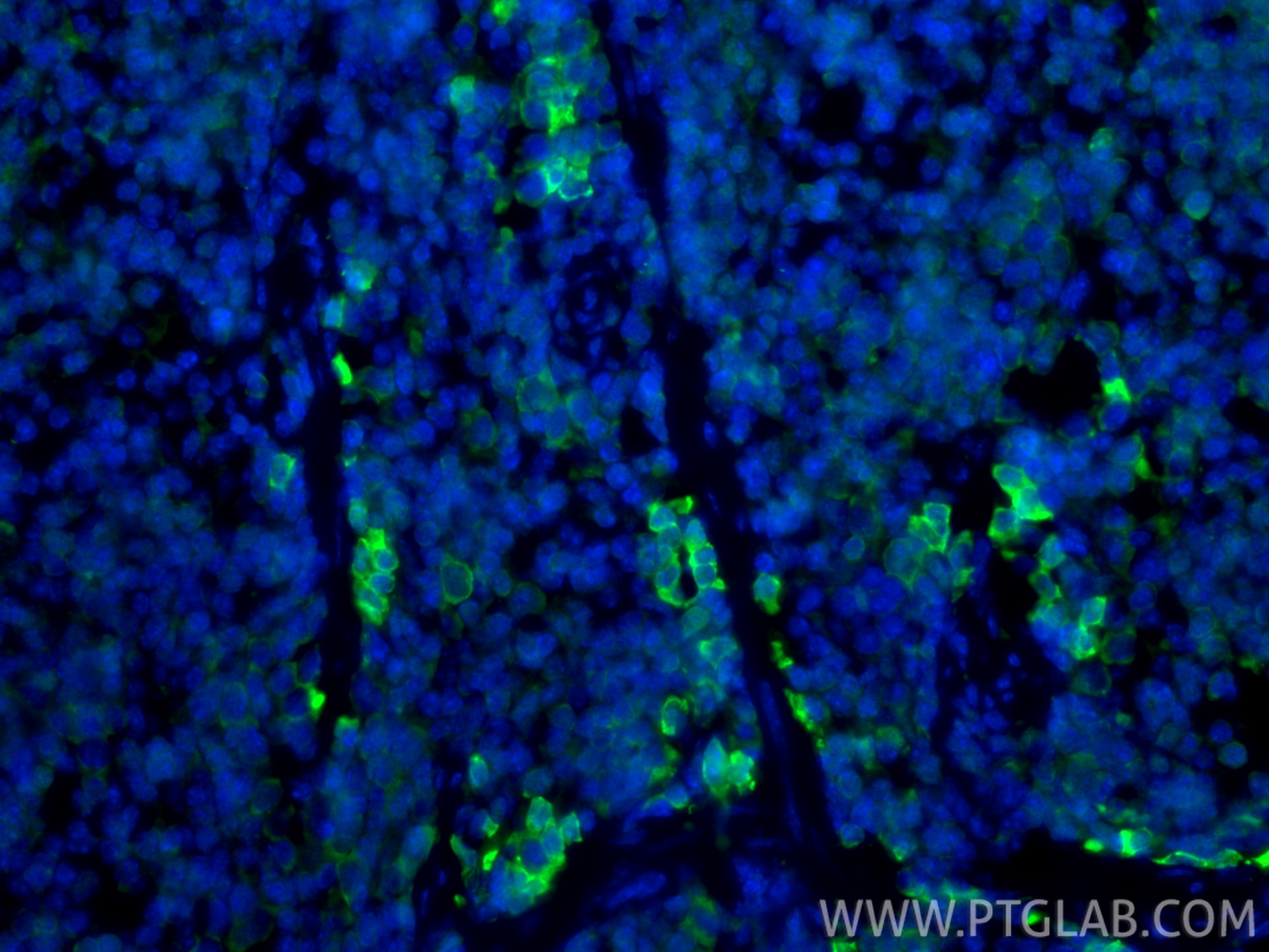 IF Staining of mouse spleen using 13588-1-AP Immunofluorescence (IF) / fluorescent staining of mouse spleen tissue using Granzyme B Polyclonal antibody (13588-1-AP)