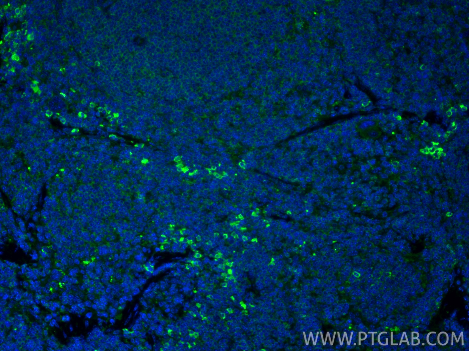 IF Staining of mouse spleen using 13588-1-AP Immunofluorescence (IF) / fluorescent staining of mouse spleen tissue using Granzyme B Polyclonal antibody (13588-1-AP)