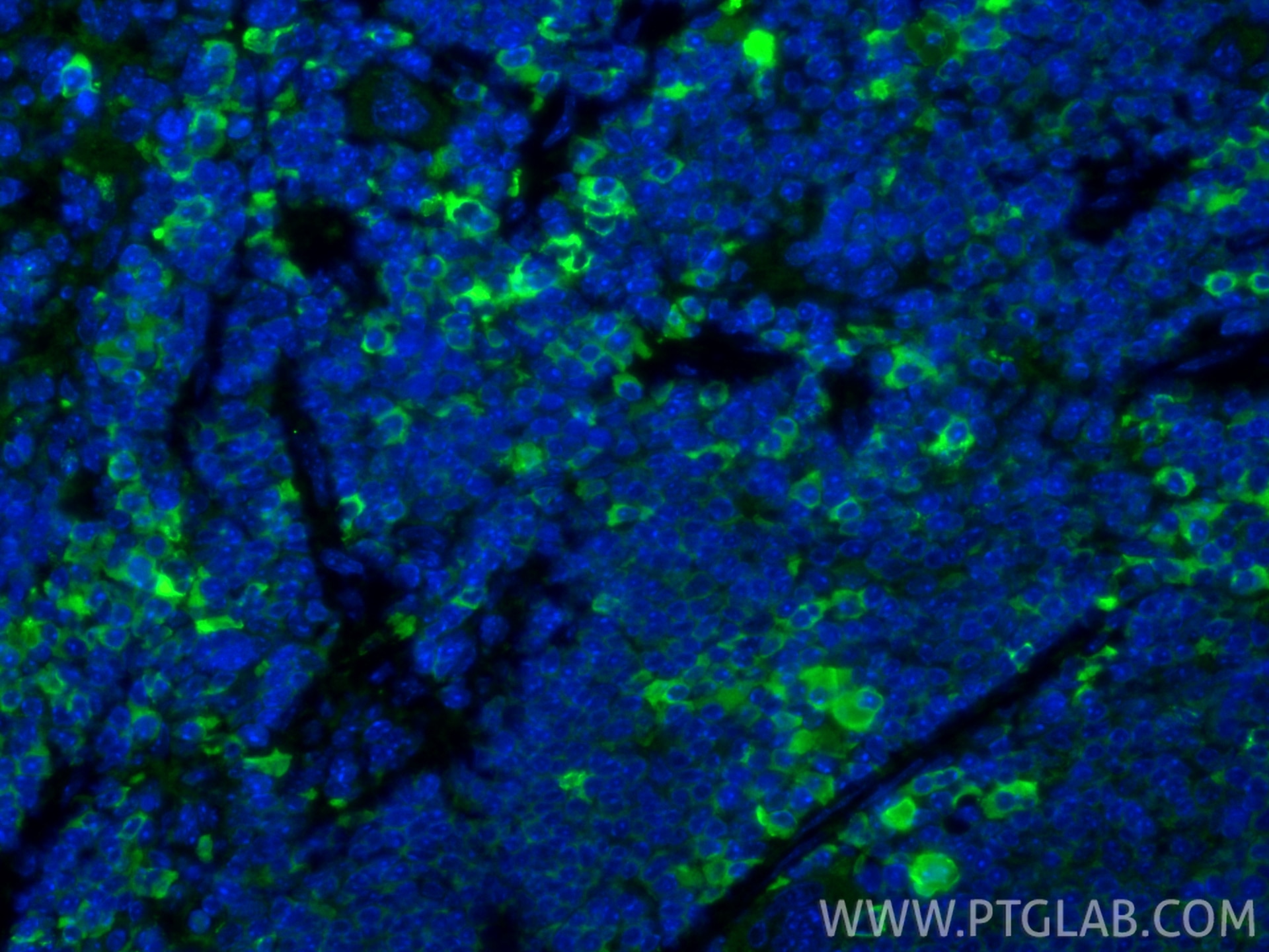 IF Staining of mouse spleen using 13588-1-AP Immunofluorescence (IF) / fluorescent staining of mouse spleen tissue using Granzyme B Polyclonal antibody (13588-1-AP)
