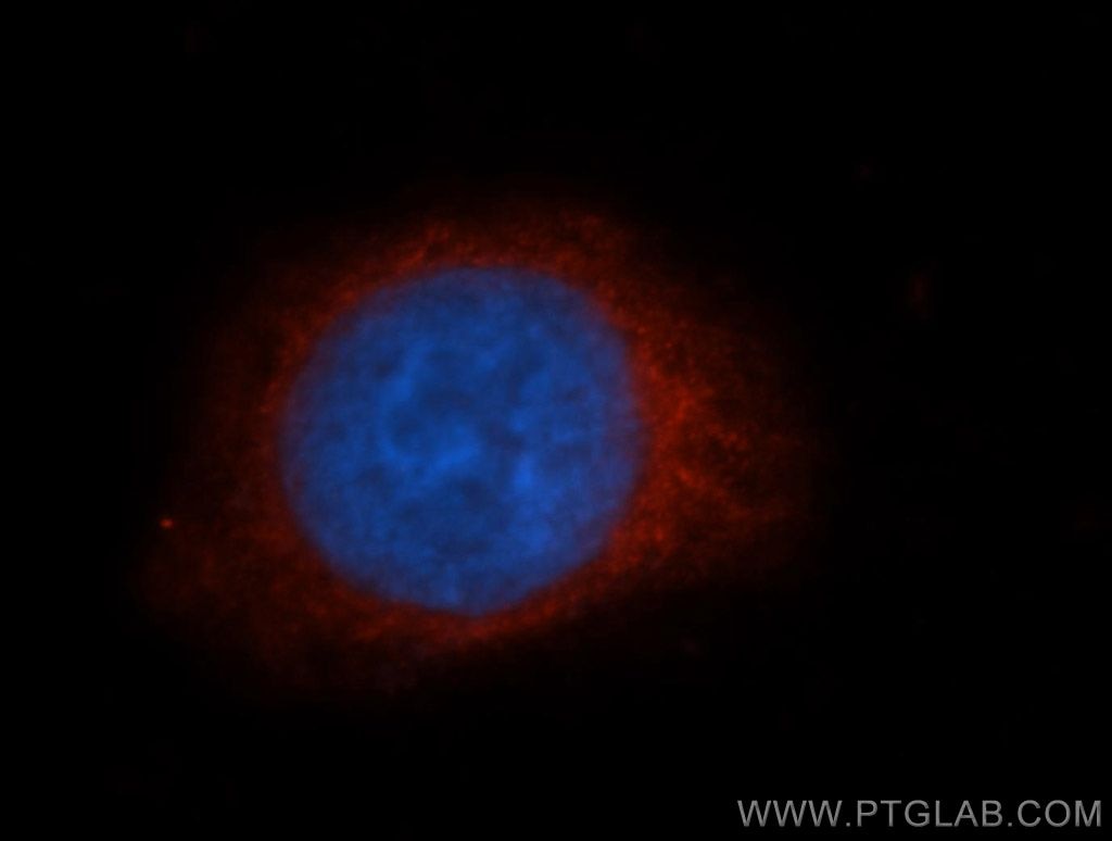 Immunofluorescence (IF) / fluorescent staining of HeLa cells using Granzyme B Polyclonal antibody (13588-1-AP)