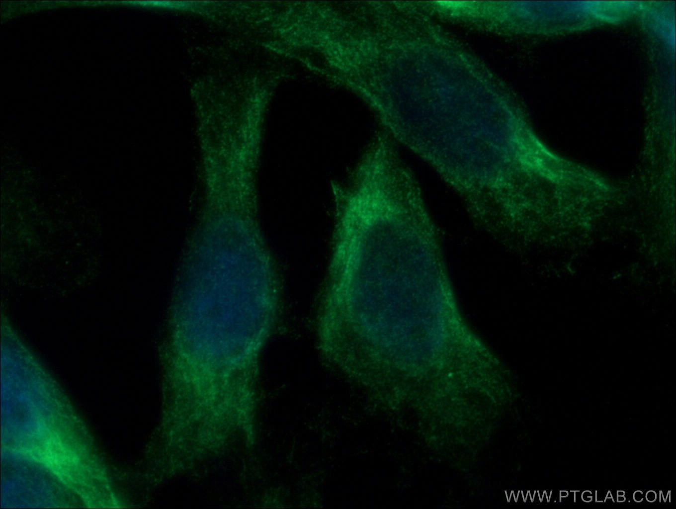 Immunofluorescence (IF) / fluorescent staining of NIH/3T3 cells using Granzyme K Polyclonal antibody (27894-1-AP)