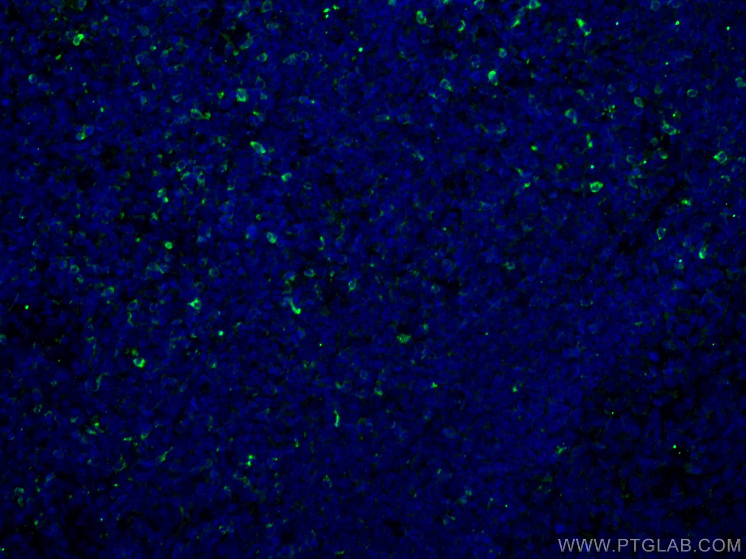 Immunofluorescence (IF) / fluorescent staining of human tonsillitis tissue using Granzyme K Monoclonal antibody (67272-1-Ig)
