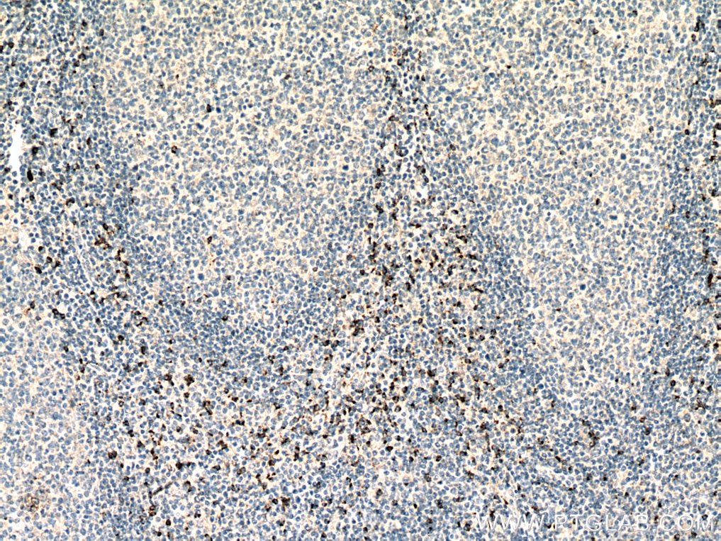 Immunohistochemistry (IHC) staining of human tonsillitis tissue using Granzyme K Monoclonal antibody (67272-1-Ig)