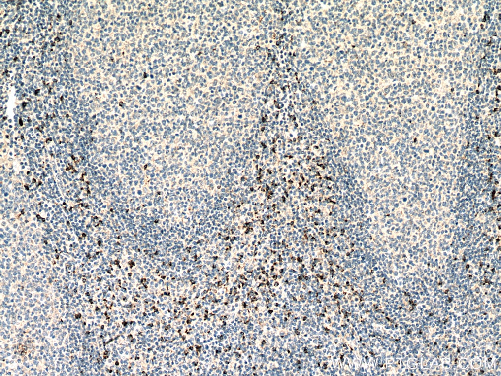 IHC staining of human tonsillitis using 67272-1-Ig