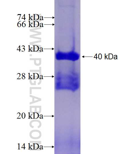 GZMK fusion protein Ag27281 SDS-PAGE