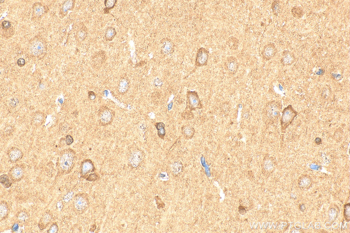 Immunohistochemical analysis of paraffin-embedded rat brain tissue slide using 13208-1-AP (Granzyme M antibody) at dilution of 1:200 (under 40x lens). Heat mediated antigen retrieval with Tris-EDTA buffer (pH 9.0). Immunohistochemistry (IHC) staining of rat brain tissue using Granzyme M Polyclonal antibody (13208-1-AP)
