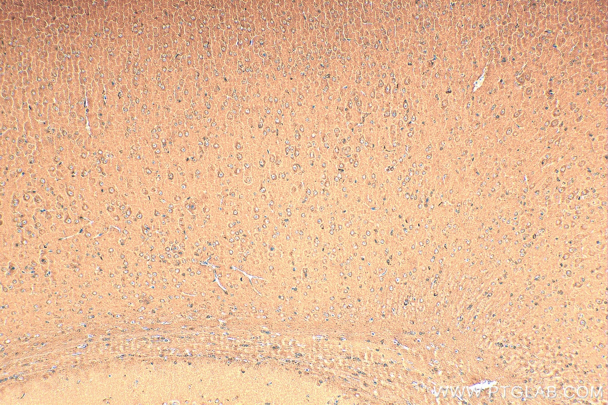 Immunohistochemistry (IHC) staining of mouse brain tissue using Galc Polyclonal antibody (11991-1-AP)