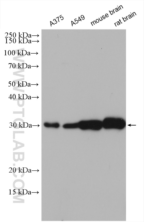 Western Blot (WB) analysis of various lysates using Galc Polyclonal antibody (11991-1-AP)