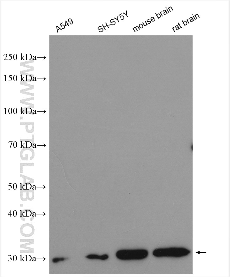 Western Blot (WB) analysis of various lysates using Galc Polyclonal antibody (11991-1-AP)