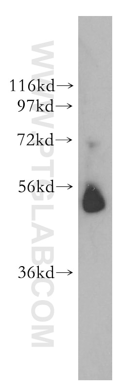 Western Blot (WB) analysis of A375 cells using Galc Polyclonal antibody (51049-2-AP)