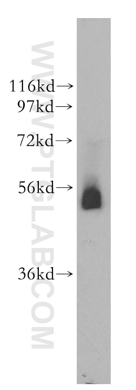Western Blot (WB) analysis of human placenta tissue using Galc Polyclonal antibody (51049-2-AP)
