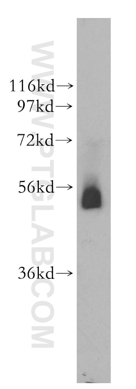 WB analysis of human placenta using 51049-2-AP