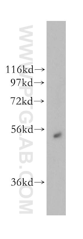 Western Blot (WB) analysis of human brain tissue using Galc Polyclonal antibody (51049-2-AP)