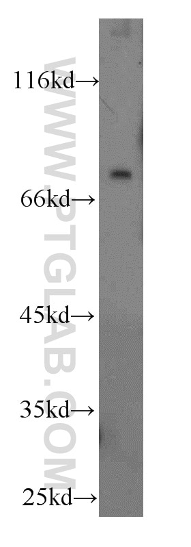 Western Blot (WB) analysis of mouse brain tissue using Galc Polyclonal antibody (51049-2-AP)