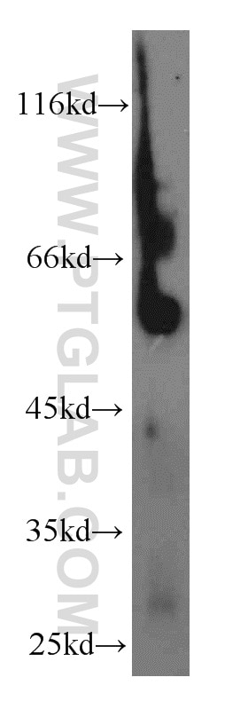 Western Blot (WB) analysis of mouse brain tissue using Galc Polyclonal antibody (51049-2-AP)